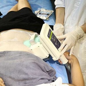 Cryolipolyse Heerhugowaard image 2